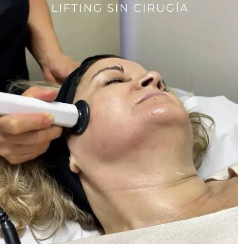 lifting sin cirugia tratamiento facial onix luxury beauty vilanova