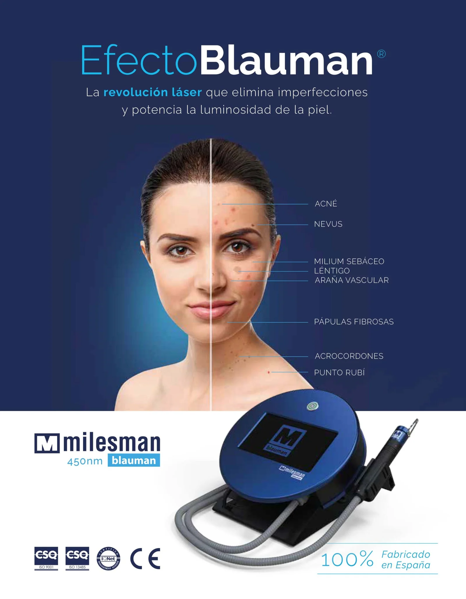 milesman blauman laser folleto